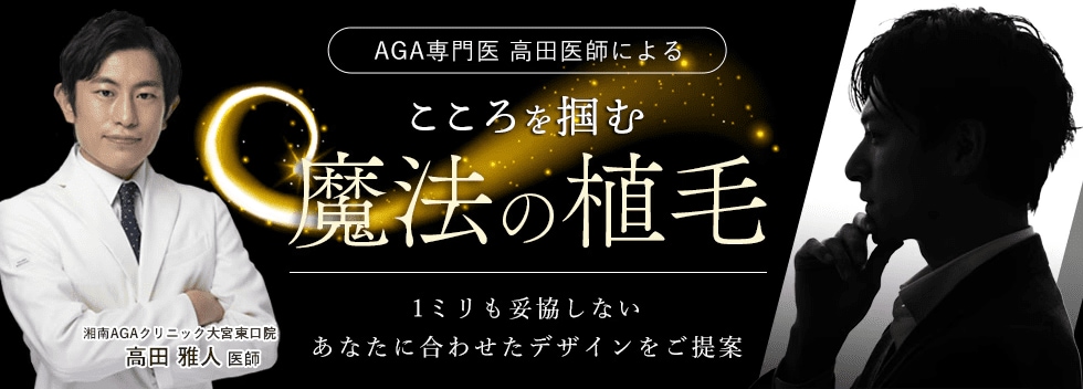 自毛植毛モニター募集中 モニター予約はこちら