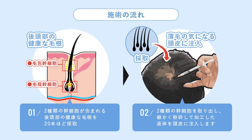 施術の流れ