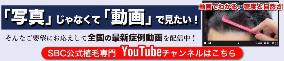 SBC公式植毛専門YouTubeチャンネル