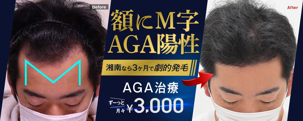 AGA治療は湘南AGAクリニック｜薄毛治療・自毛植毛の専門病院