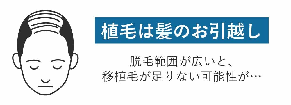 自毛植毛は「髪の毛のお引越し」