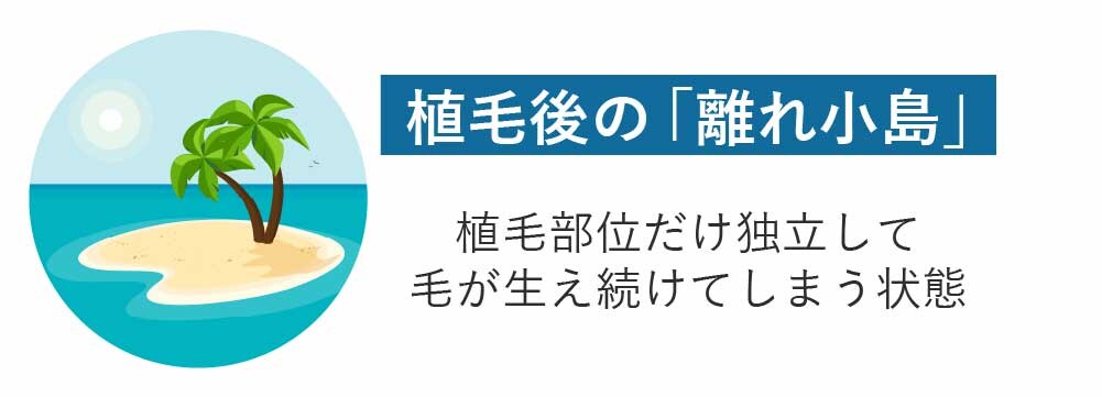 「離れ小島」になるリスクが大きい