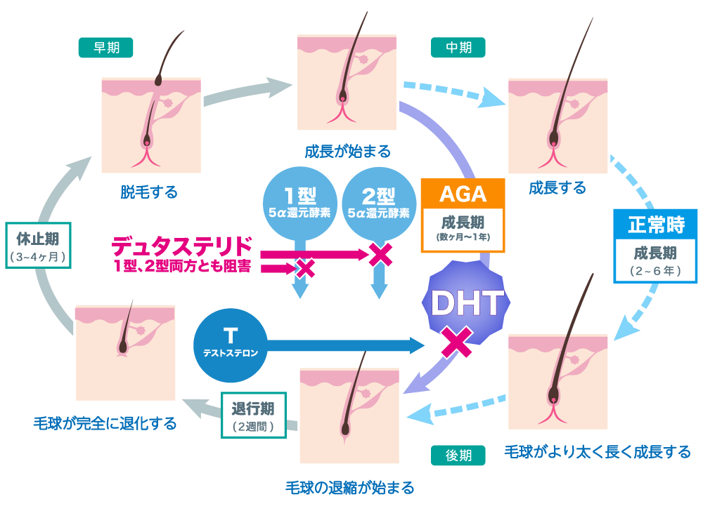 ディユタステリドの効果について