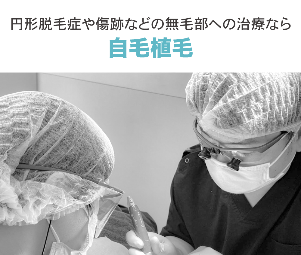 生え際やM字部分、頭頂に毛穴さえない方