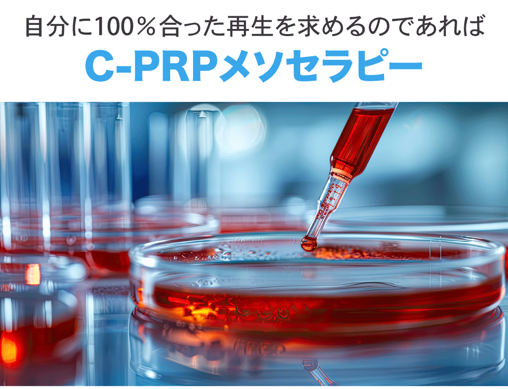 C-PRPメソセラピー