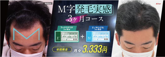 M字発毛実感3ヶ月コース