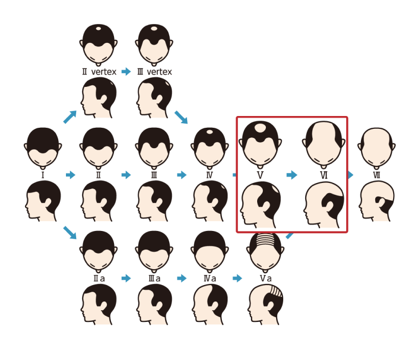 進行度を図で確認