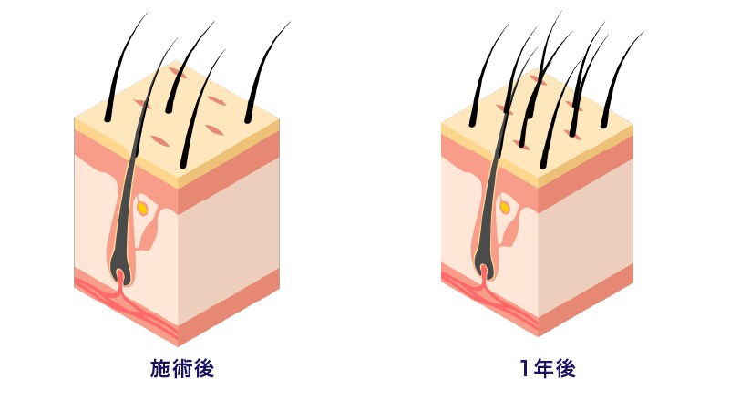 施術のメリット