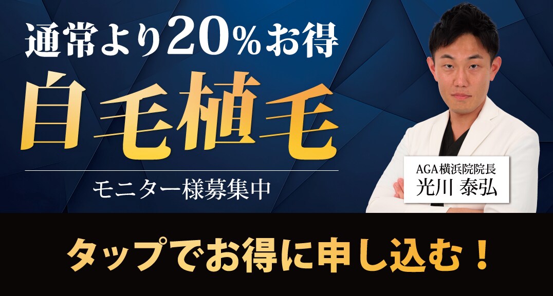 湘南AGAクリニック横浜院のモニター募集