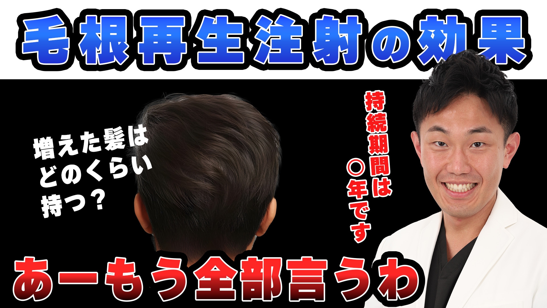 【薄毛】毛根再生注射(旧ダブル マトリックス)の効果はいつまで続く？専門医が徹底解説！